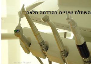 טיפולי שיניים בהרדמה מלאה יתרונות וחסרונות