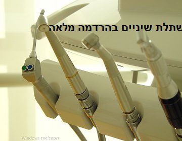 טיפולי שיניים בהרדמה מלאה יתרונות וחסרונות 