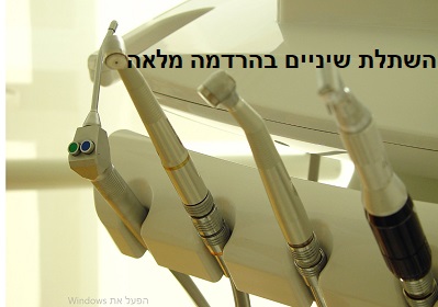 טיפולי שיניים בהרדמה מלאה יתרונות וחסרונות